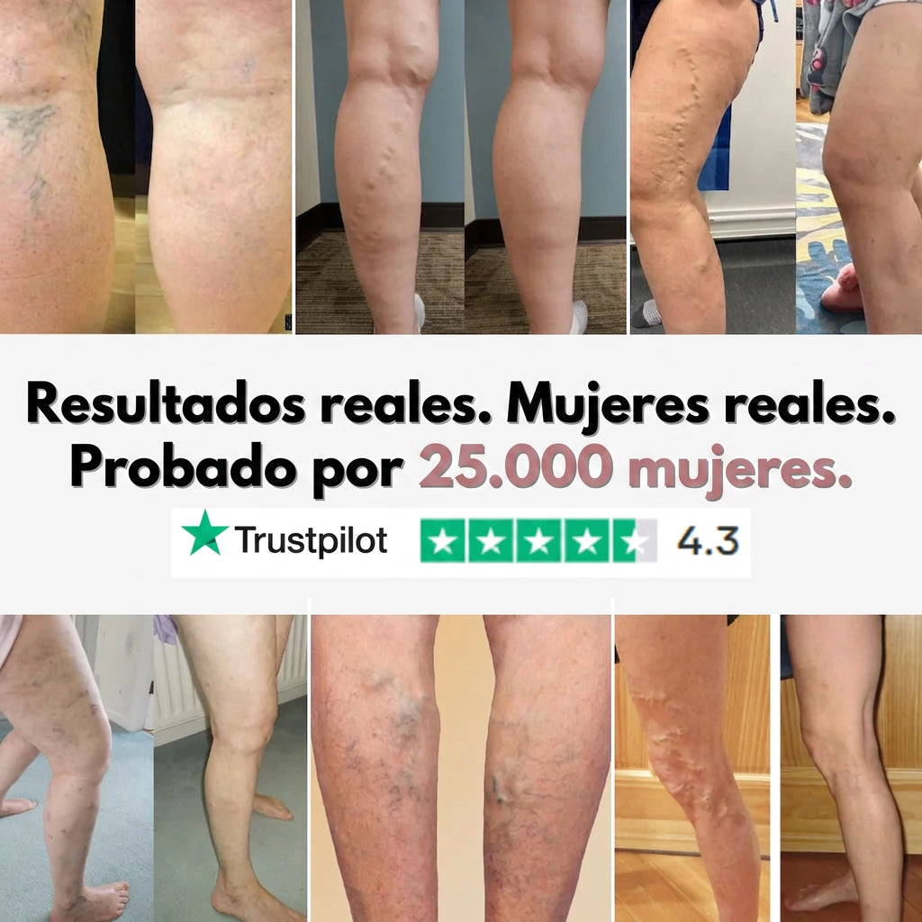 De arañas vasculares y piernas pesadas a un alivio visible para profesionales sanitarios en 14 días.
