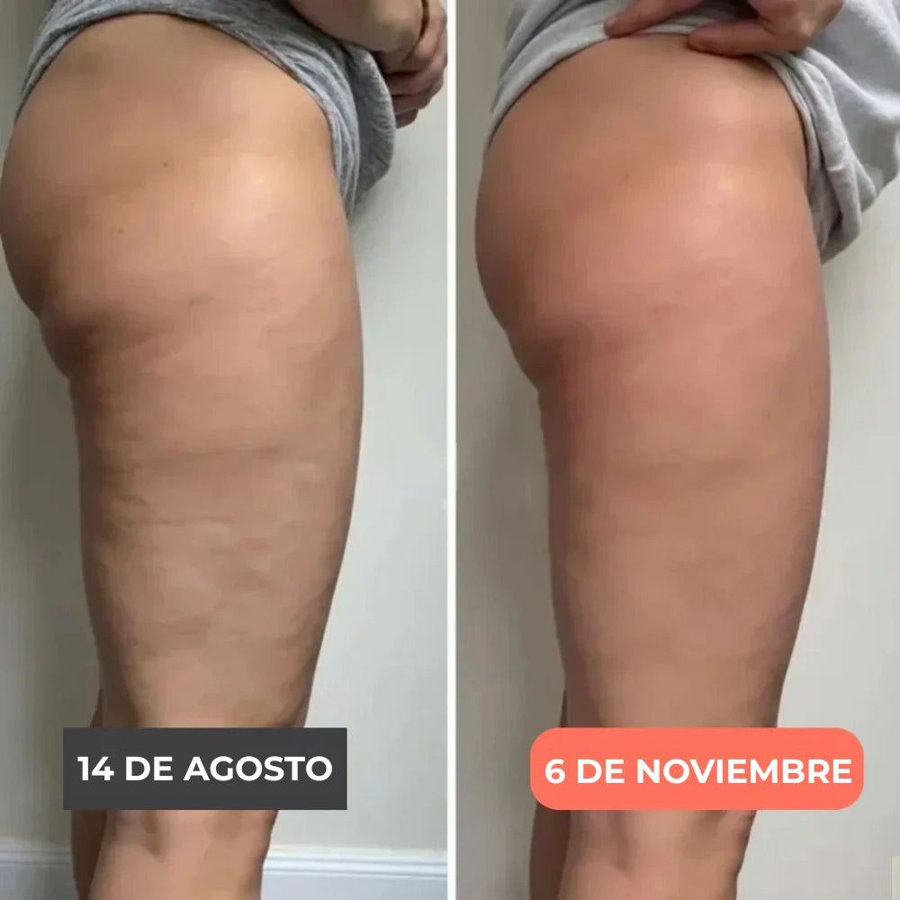 Legging 3D Cellumove – Redefine tu silueta sin esfuerzo