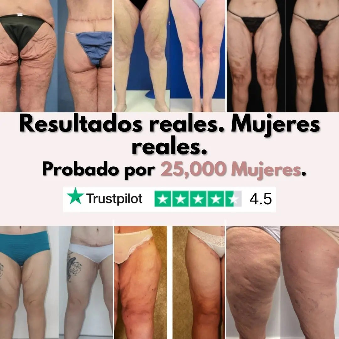 Piernas más firmes y suaves en 14 días — para mujeres cansadas de que la piel flácida las detenga (modelo normal)