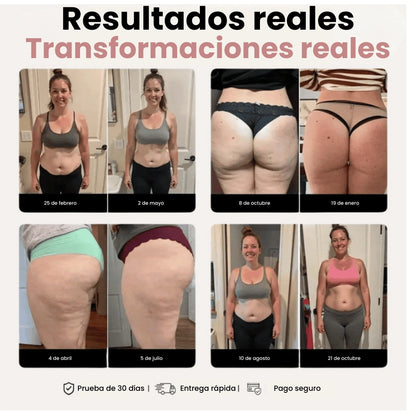 Cellumove 3D Legging – Redefine your silhouette effortlessly
