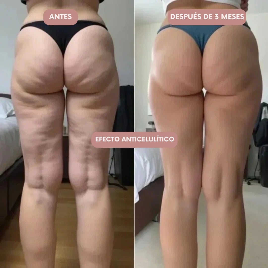 Legging 3D Cellumove – Redefine tu silueta sin esfuerzo